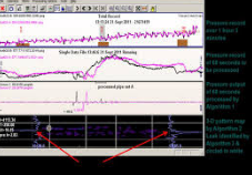 External Leak Detection Evaluation and Development: Field Testing of Negative-Wave Leak Detection Systems
