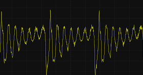SCC-2-12 Effect of Pressure Fluctuations on Growth Rate of Near-Neutral pH SCC